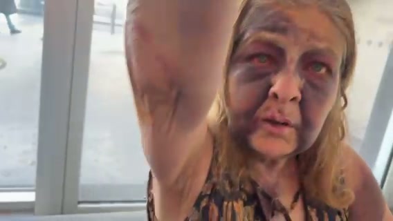 Evidence of injuries - August 2025 - 2