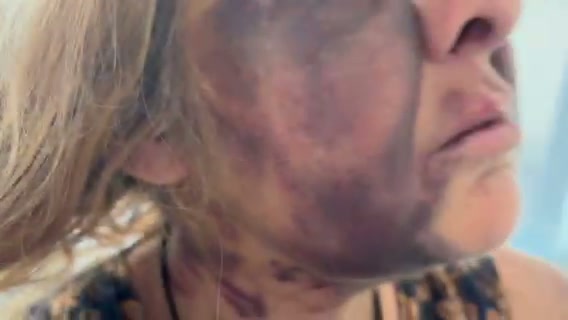 Evidence of injuries - August 2025 - 3