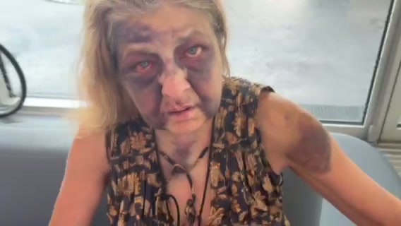 Evidence of injuries - August 2025 - 4