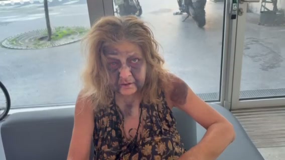 Evidence of injuries - August 2025 - 7